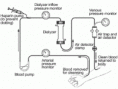 /album/fotogaleria/hemodialysis-schematic-gif/